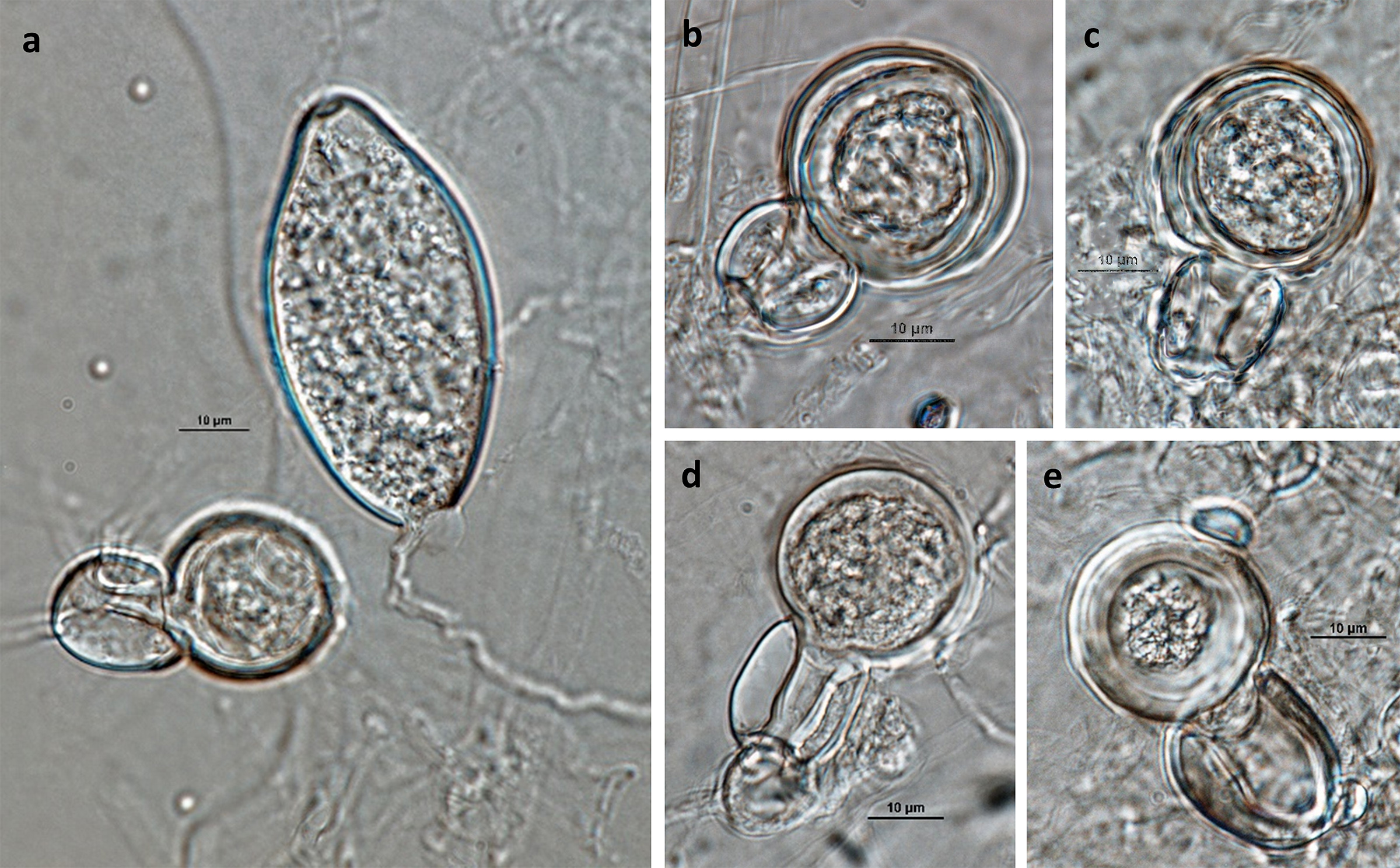   Phytophthora ramorumnbsp; (ex-type CPHST BL 55G) sexual phase (andash;e): (a) sporangium and sexual phase, (bndash;e) gametangia and plerotic oospores of ex-type (A1, EU1) produced with tester strainnbsp; P. capsici nbsp;(A2, ex-type CPHST BL 33); photos by Gloria Abad, USDA-APHIS-PPQ. 
